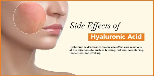 Hyaluronic Acid Powder