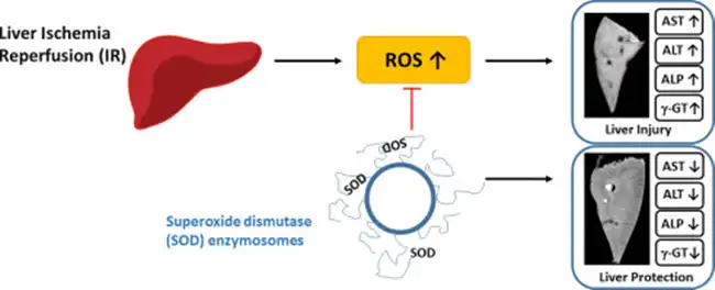 Superoxide Dismutase Superoxide Dismutase