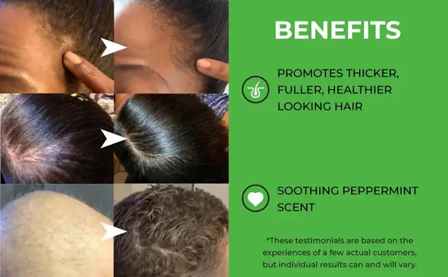 biotin powder for hair biotin powder for hair