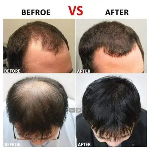 coenzyme q10 for hair coenzyme q10 for hair