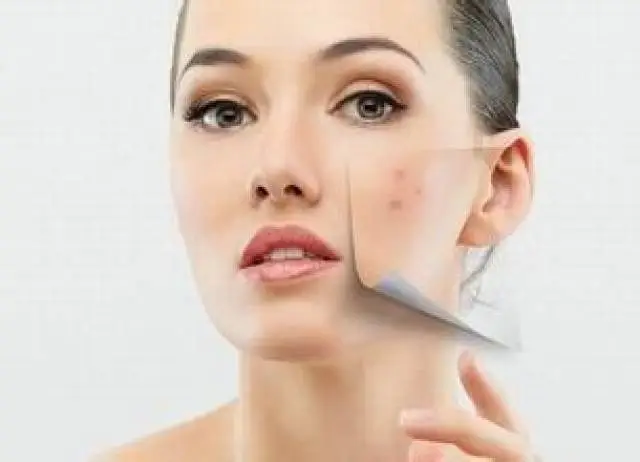 pure alpha arbutin powder pure alpha arbutin powder